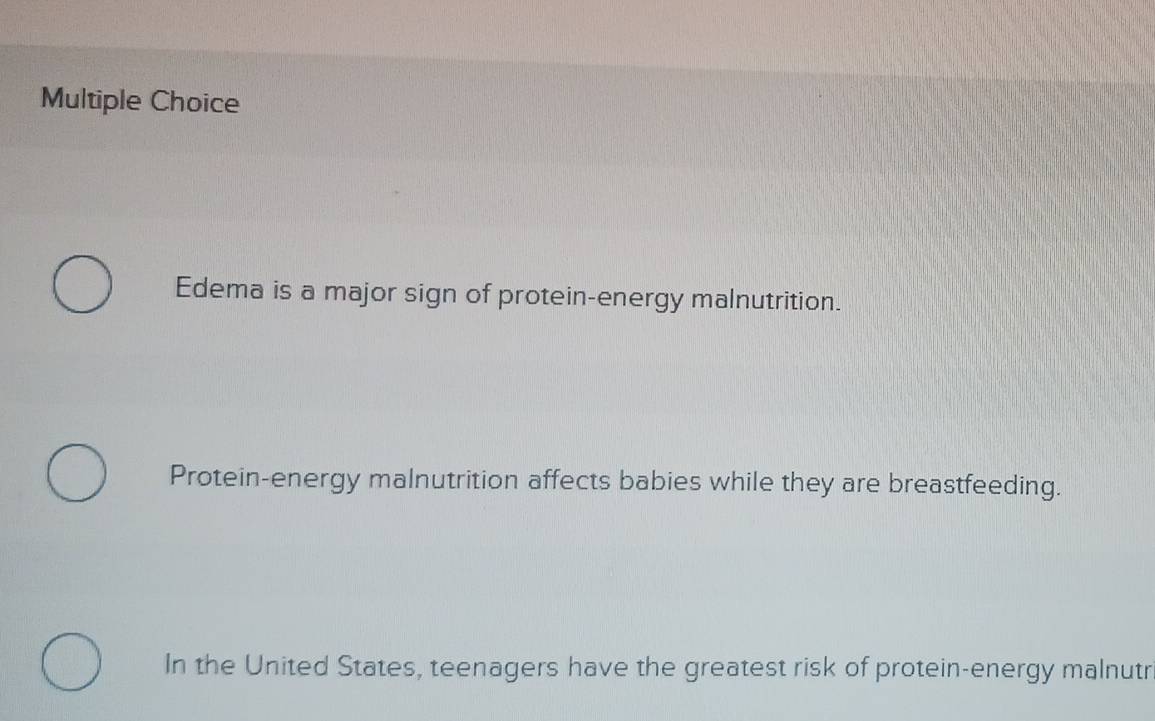 Edema is a major sign of protein-energy malnutrition.
Protein-energy malnutrition affects babies while they are breastfeeding.
In the United States, teenagers have the greatest risk of protein-energy malnutr