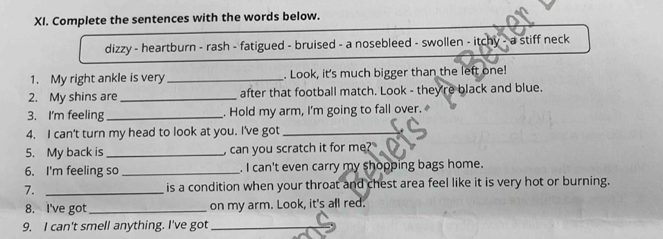 Complete the sentences with the words below. 
dizzy - heartburn - rash - fatigued - bruised - a nosebleed - swollen - itchy - a stiff neck 
1. My right ankle is very _. Look, it's much bigger than the left one! 
2. My shins are _after that football match. Look - they're black and blue. 
3. I'm feeling_ . Hold my arm, I'm going to fall over. 
4. I can’t turn my head to look at you. I've got_ 
5. My back is _, can you scratch it for me? 
6. I'm feeling so _. I can't even carry my shopping bags home. 
7. _ is a condition when your throat and chest area feel like it is very hot or burning. 
8. I've got_ on my arm. Look, it's all red. 
9. I can't smell anything. I've got_