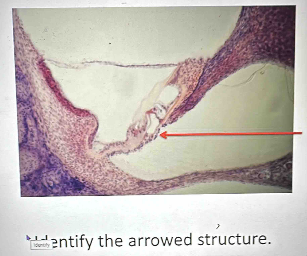 identify entify the arrowed structure.