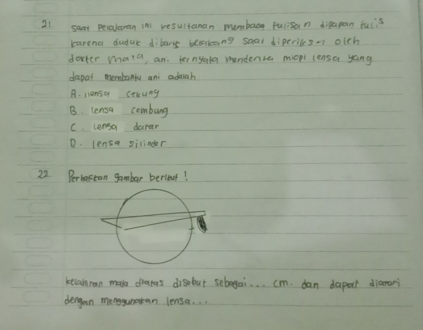 saat pecalaran inl resultanan membacg fulisan dipapan fuiis
karena dudur dibars bleuakang saat diperiles. oich
dovter mara, an: terngata mendenra miopl lensa yang
dapat membanta ani adaah
A. llensa cokung
B. lensa cembung
C. lensa darar
D. lensa silinder
22. Perharcan gambar beritur!
kelanran mala diatas disebut sebagai. . . cm. dan dapat diarari
dengan menggunaran lensa. . .