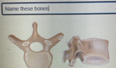 Name these bones