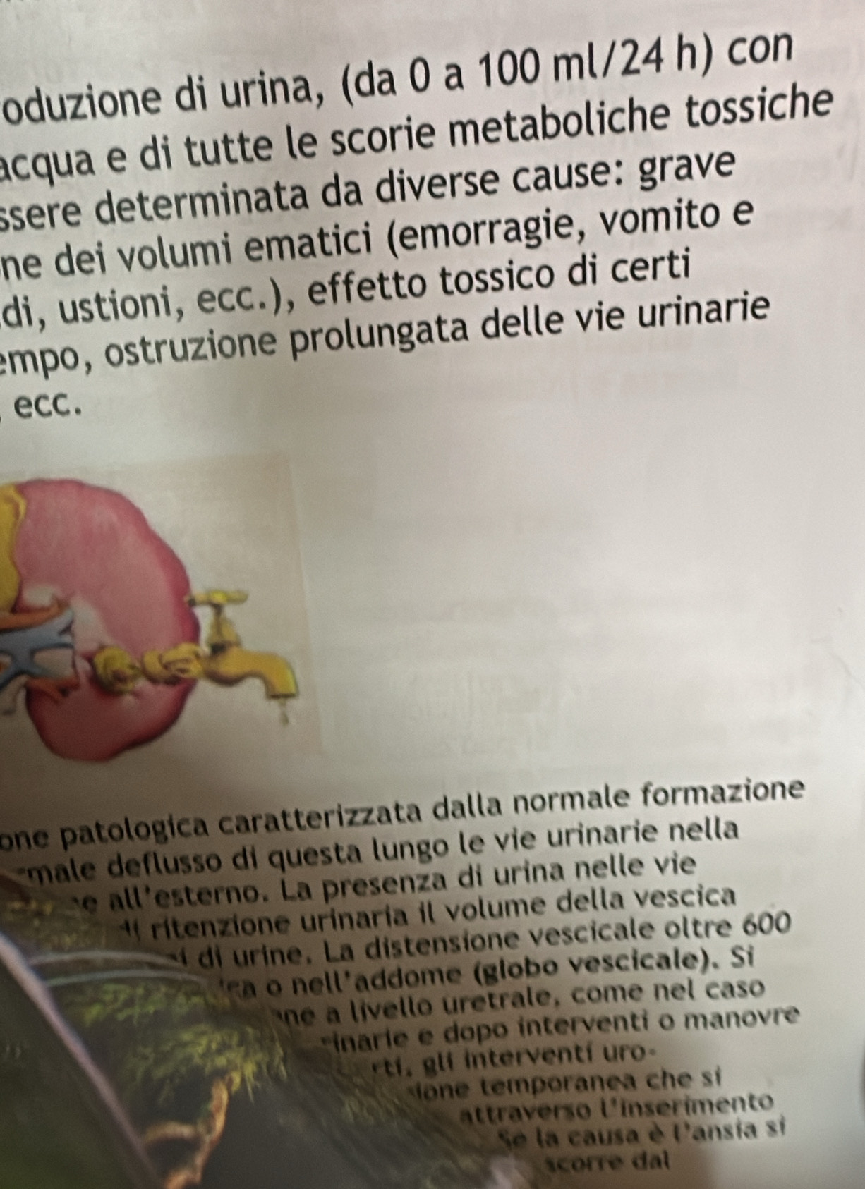 oduzione di urina, (da 0 a 100 ml/24 h) con 
acqua e di tutte le scorie metaboliche tossiche 
ssere determinata da diverse cause: grave 
ne dei volumi ematici (emorragie, vomito e 
di, ustioni, ecc.), effetto tossico di certi 
empo, ostruzione prolungata delle vie urinarie 
ecc. 
one patologica caratterizzata dalla normale formazione 
âmale deflusso di questa lungo le vie urinarie nella 
he all'esterno. La presenza di urina nelle vie 
1 rítenzione urinaria il volume della vescica
4 di urine. La distensione vescicale oltre 600
c e l'addome (globo vescicale). Si 
ne i ello uretrale, come nel caso 
rinarie e o p o interventi o manovr 
t ent í ro 
m ora h si 
ttr erso linserimento 
Se la causa è P'ansia si 
scorre dl