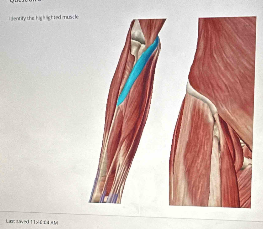 Identify the highlighted muscle 
Last saved 11:46:04 AM