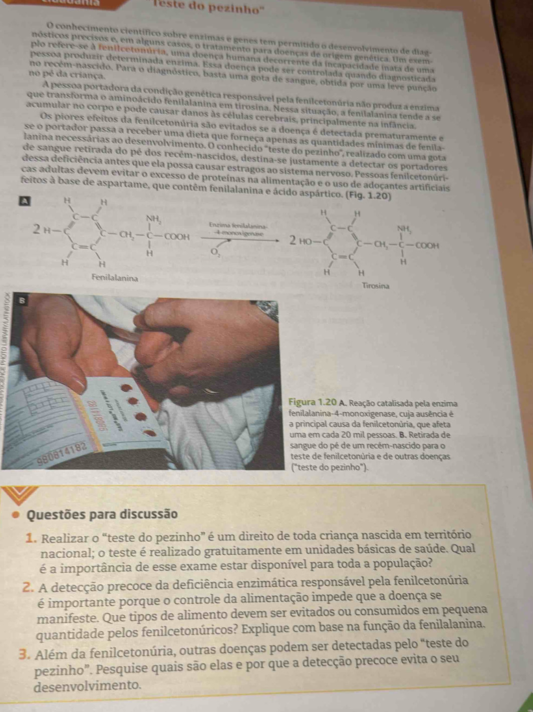 leste do pezinho''
O conhecimento científico sobre enzimas e genes tem permítido o desenvolvimento de diag-
nósticos precisos e, em alguns casos, o tratamento para doenças de origem genética. Um exem-
plo refere-se à fenilcetonúria, uma doença humana decorrente da incapacidade inata de uma
pessoa produzir determinada enzima. Essa doença pode ser controlada quando diagnosticada
no pé da criança.
no recém-nascido. Para o diagnóstico, basta uma gota de sangue, obtida por uma leve punção
A pessoa portadora da condição genética responsável pela fenilcetonúria não produz a enzima
que transforma o aminoácido fenilalanina em tirosina. Nessa situação, a fenilalanina tende a se
acumular no corpo e pode causar danos às células cerebrais, principalmente na infância.
Os piores efeitos da fenilcetonúria são evitados se a doença é detectada prematuramente e
se o portador passa a receber uma dieta que forneça apenas as quantidades mínimas de fenila-
lanina necessárias ao desenvolvimento. O conhecido "teste do pezinho", realizado com uma gota
de sangue retirada do pé dos recém-nascidos, destina-se justamente a detectar os portadores
dessa deficiência antes que ela possa causar estragos ao sistema nervoso. Pessoas fenilcetonúri-
cas adultas devem evitar o excesso de proteínas na alimentação e o uso de adoçantes artificiais
feitos à base de aspartame, que contêm fenilalanina e ácido aspártico. (Fig.1.20
A 2n-sumlimits  2nto ∈fty frac (∈tlimits _i=1)^n-alpha _i-alpha overline (∈tlimits _i=1)^ncos alpha 
4 monoxigenase 
Enzima fenilalanina-
□
□  O_2
Fenilalanina
1.20 A. Reação catalisada pela enzima
nina-4-monoxigenase, cuja ausência é
pal causa da fenilcetonúria, que afeta
cada 20 mil pessoas. B. Retirada de
do pé de um recém-nascido para o
e fenilcetonúria e de outras doenças
do pezinho").
Questões para discussão
1. Realizar o “teste do pezinho” é um direito de toda criança nascida em território
nacional; o teste é realizado gratuitamente em unidades básicas de saúde. Qual
é a importância de esse exame estar disponível para toda a população?
2. A detecção precoce da deficiência enzimática responsável pela fenilcetonúria
é importante porque o controle da alimentação impede que a doença se
manifeste. Que tipos de alimento devem ser evitados ou consumidos em pequena
quantidade pelos fenilcetonúricos? Explique com base na função da fenilalanina.
3. Além da fenilcetonúria, outras doenças podem ser detectadas pelo “teste do
pezinho”. Pesquise quais são elas e por que a detecção precoce evita o seu
desenvolvimento.