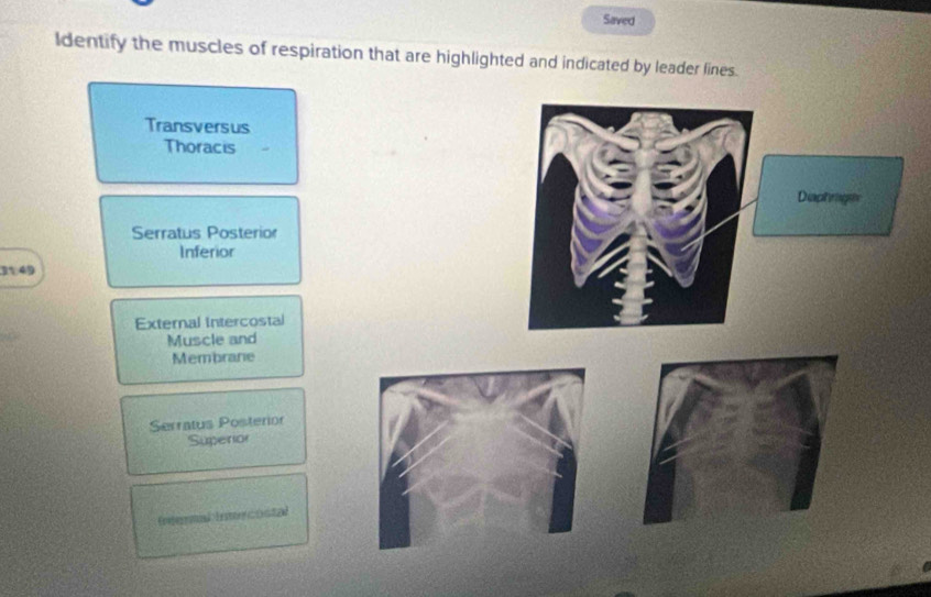 Saved 
Identify the muscles of respiration that are highlighted and indicated by leader lines. 
Transversus 
Thoracis 
Serratus Posterior 
Inferior
349
External Intercostal 
Muscle and 
Membrane 
Serratus Posterior 
Superior 
Enfer d Er te