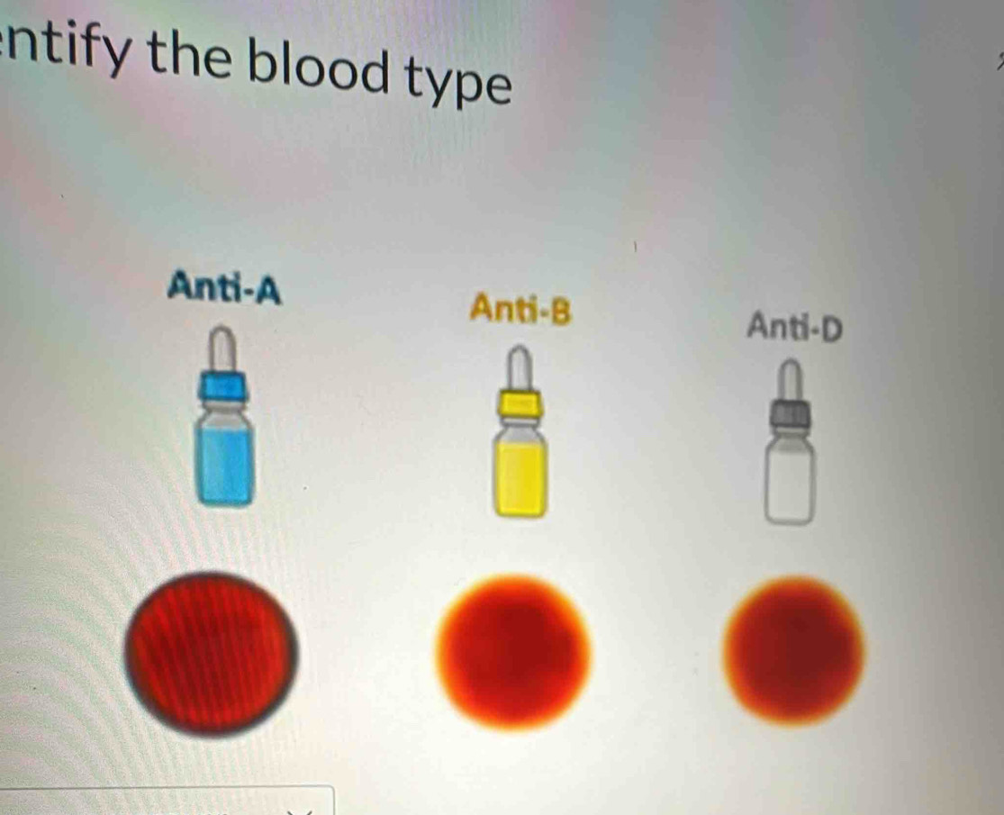 intify the blood type .
Anti-A Anti-B
Anti-D