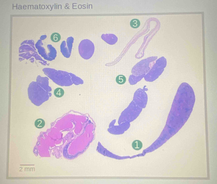 Haematoxylin & Eosin