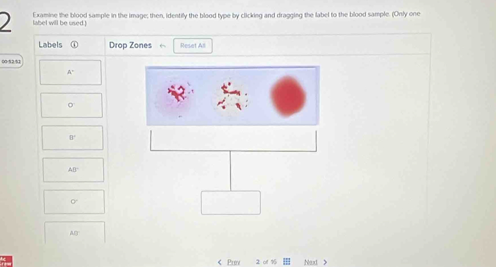 Solved: Examine the blood sample in the Image; then, identify the blood ...
