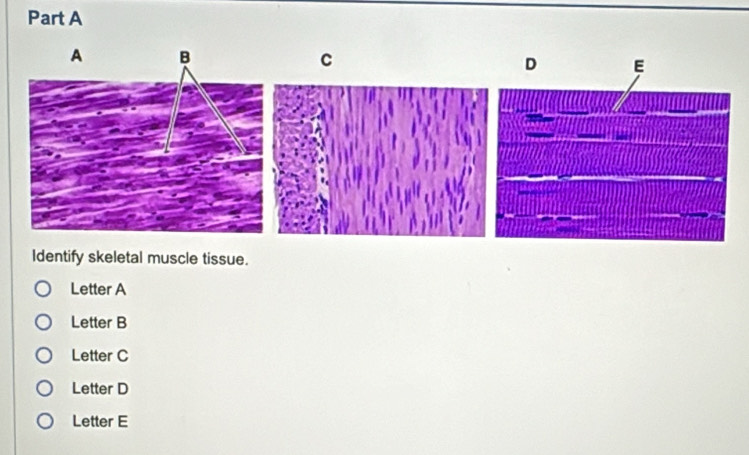 Solved: Identify skeletal muscle tissue. Letter A Letter B Letter C ...