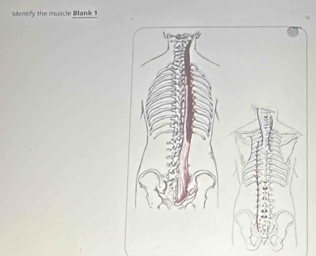 dentify the muscie Blank 1