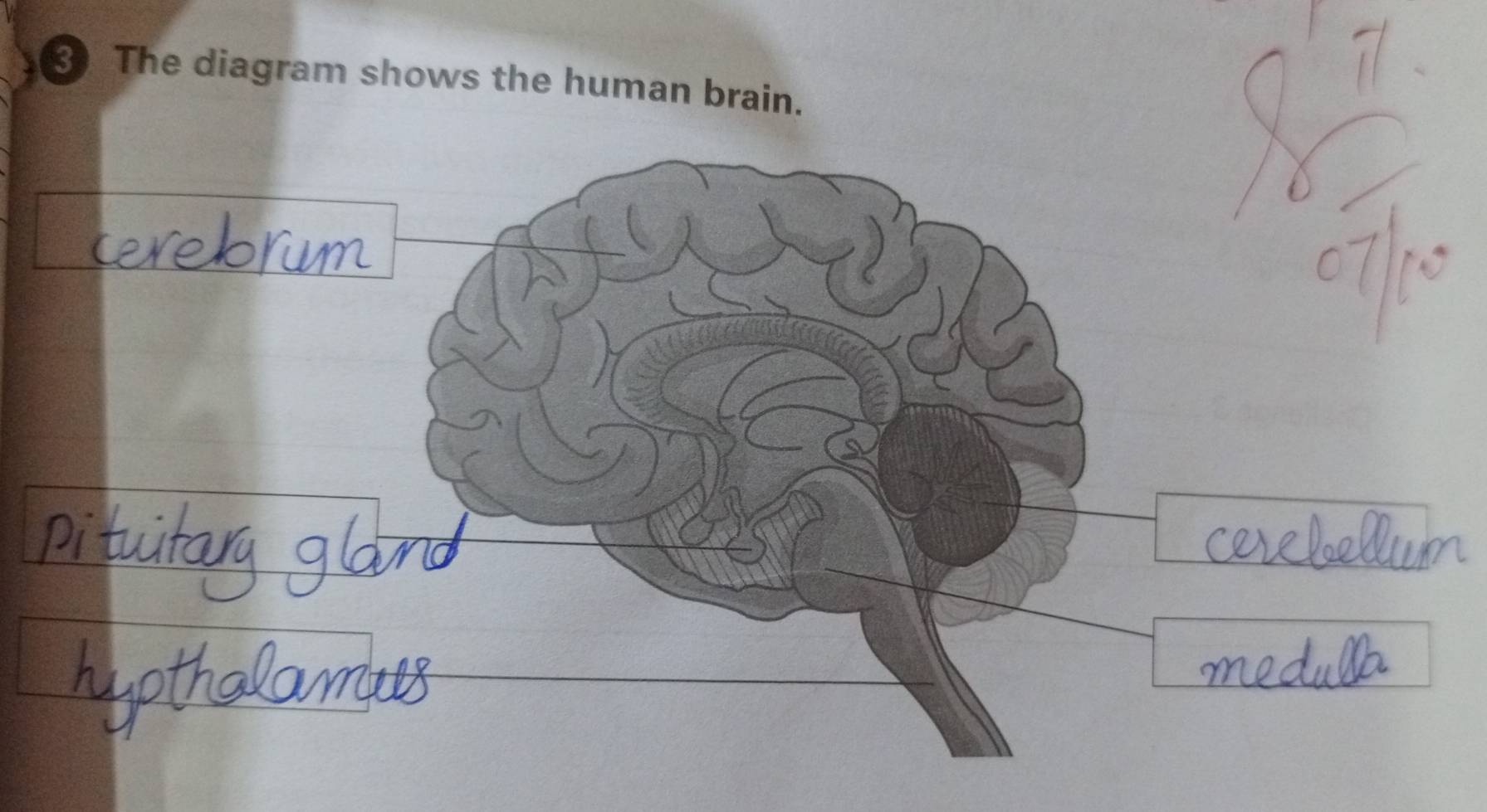 The diagram shows the human brain.