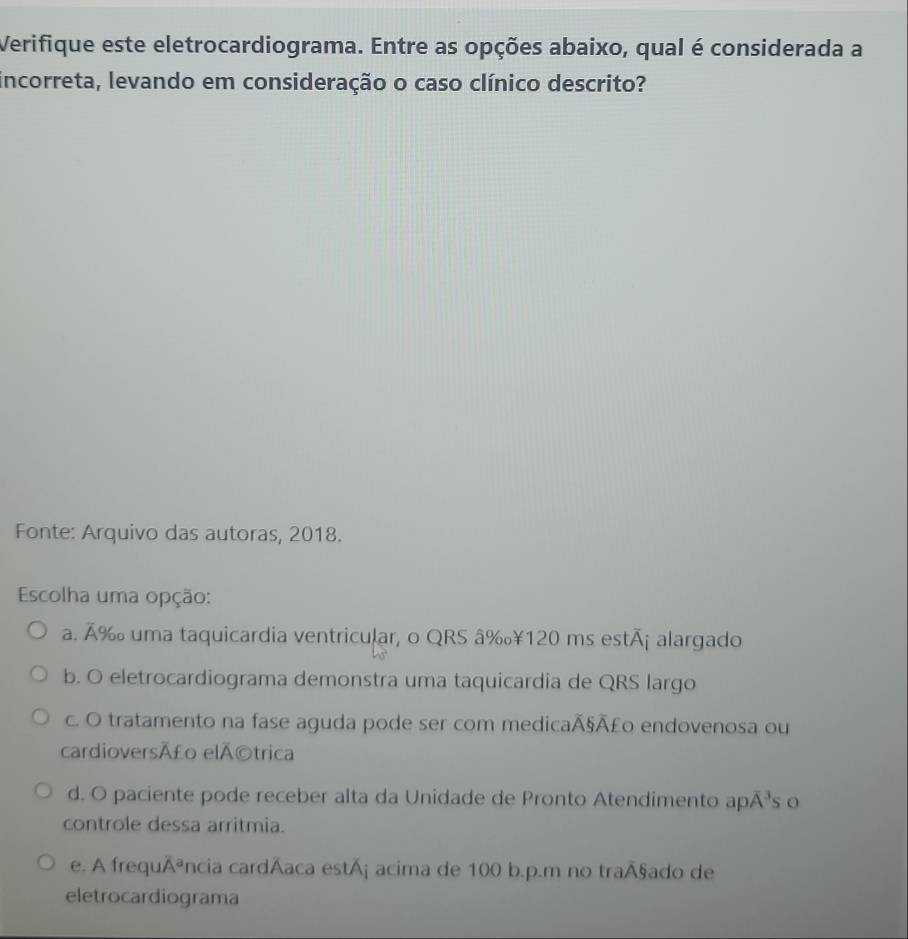 Verifique este eletrocardiograma. Entre as opções abaixo, qual é considerada a
incorreta, levando em consideração o caso clínico descrito?
Fonte: Arquivo das autoras, 2018.
Escolha uma opção:
a. Â‰ uma taquicardia ventricular, o QRS â‰¥ 120 ms estã¡ alargado
b. O eletrocardiograma demonstra uma taquicardia de QRS largo
c. O tratamento na fase aguda pode ser com medicaÃ§Ã£o endovenosa ou
cardioversÃ£o elÃ©trica
d. O paciente pode receber alta da Unidade de Pronto Atendimento apA³s o
controle dessa arritmia.
e. A frequÃência cardáaca está¡ acima de 100 b.p.m no traÃ§ado de
eletrocardiograma