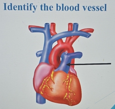 Identify the blood vessel