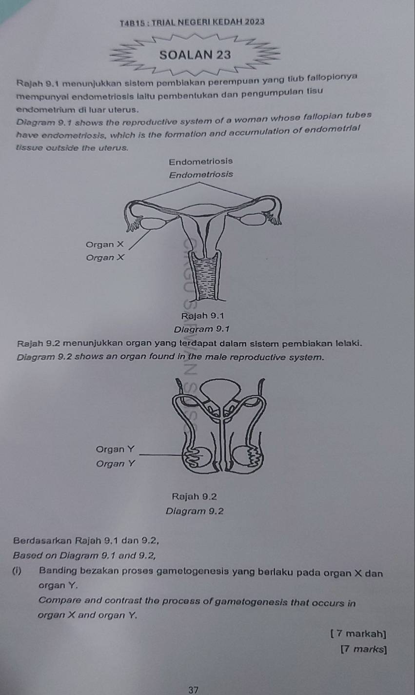 T4B15 : TRIAL NEGERI KEDAH 2023 
SOALAN 23 
Rajah 9.1 menunjukkan sistem pembiakan perempuan yang tiub fallopionya 
mempunyal endometriosis laitu pembentukan dan pengumpulan tisu 
endometrium di luar uterus. 
Diagram 9.1 shows the reproductive system of a woman whose fallopian tubes 
have endometriosis, which is the formation and accumulation of endometrial 
tissue outside the uterus. 
Rajah 9.2 menunjukkan organ yang terdapat dalam sistem pembiakan lelaki. 
Diagram 9.2 shows an organ found in the male reproductive system. 
Diagram 9.2 
Berdasarkan Rajah 9.1 dan 9.2, 
Based on Diagram 9.1 and 9.2, 
(i) Banding bezakan proses gamelogenesis yang berlaku pada organ X dan 
organ Y. 
Compare and contrast the process of gametogenesis that occurs in 
organ X and organ Y. 
[ 7 markah] 
[7 marks] 
37