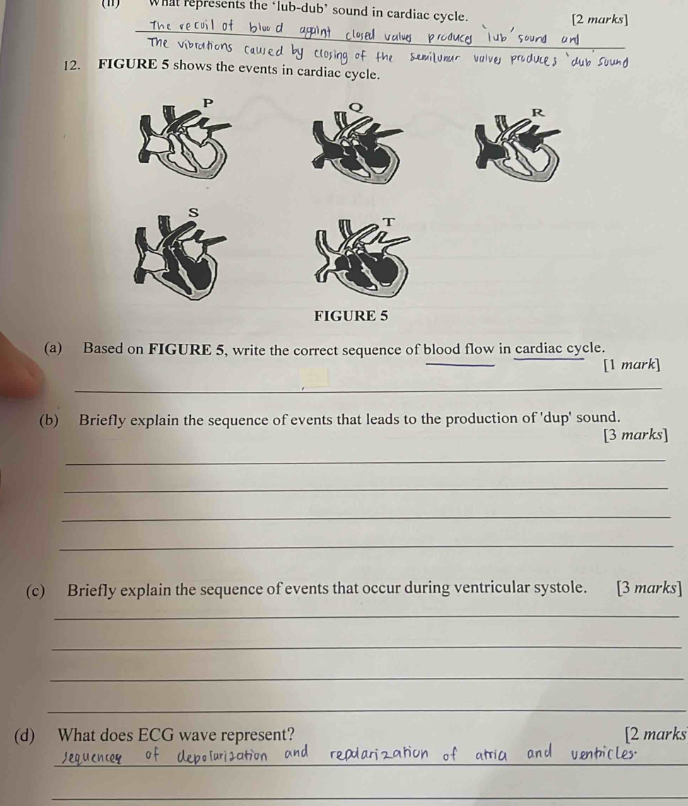 (II) What represents the ‘lub-dub’ sound in cardiac cycle. [2 marks] 
_ 
The v ib rato c by_ 
Au so un d 
12. FIGURE 5 shows the events in cardiac cycle. 
R 
T 
FIGURE 5 
(a) Based on FIGURE 5, write the correct sequence of blood flow in cardiac cycle. 
_ 
[1 mark] 
_ 
(b) Briefly explain the sequence of events that leads to the production of 'dup' sound. 
[3 marks] 
_ 
_ 
_ 
_ 
(c) Briefly explain the sequence of events that occur during ventricular systole. [3 marks] 
_ 
_ 
_ 
_ 
(d) What does ECG wave represent? [2 marks 
_ 
_