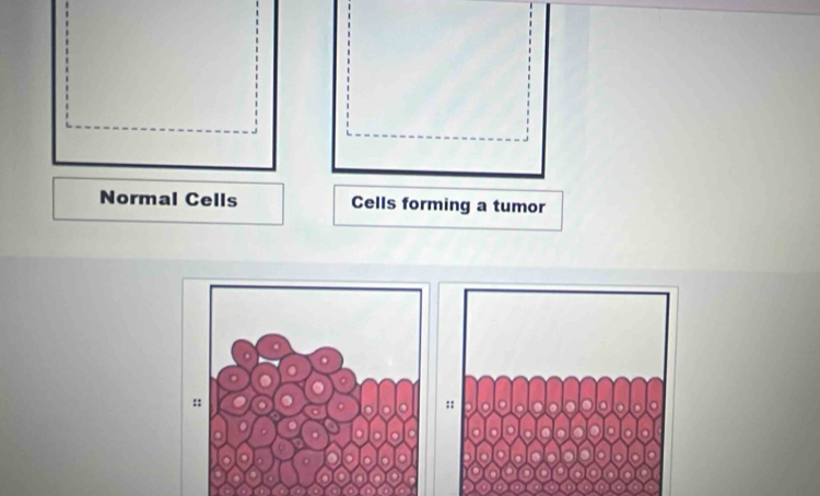 Normal Cells Cells forming a tumor