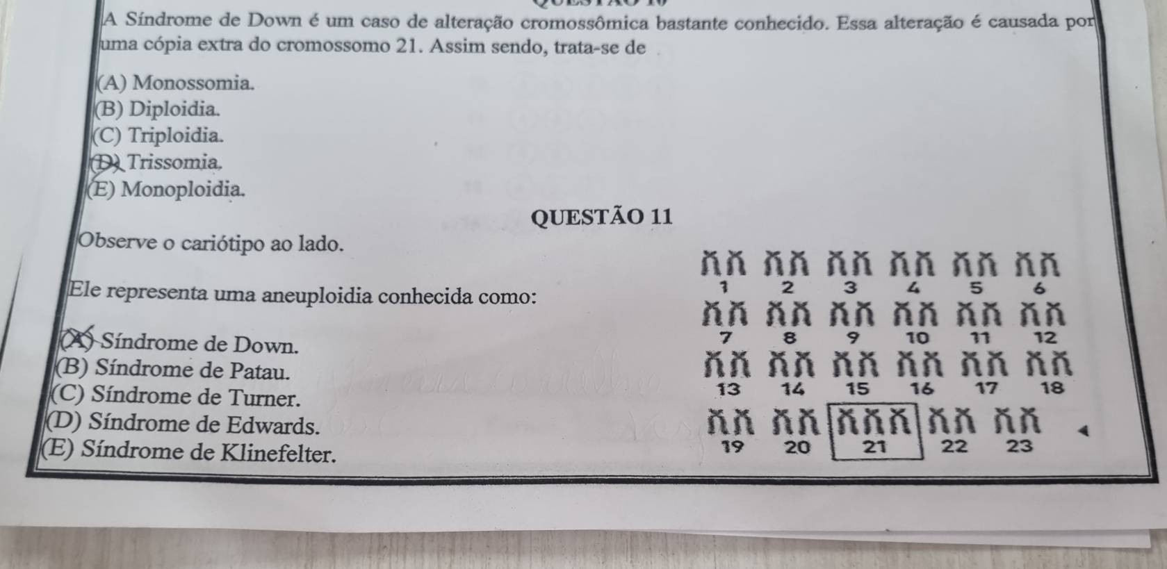 A Síndrome de Down é um caso de alteração cromossômica bastante conhecido. Essa alteração é causada por
uma cópia extra do cromossomo 21. Assim sendo, trata-se de
(A) Monossomia.
(B) Diploidia.
(C) Triploidia.
DTrissomia,
(E) Monoploidia.
QUESTÃO 11
Observe o cariótipo ao lado.
ňň ňň ňň ňň ňň ňň
Ele representa uma aneuploidia conhecida como:
2 3 4 5
ňň ňň ňň ň ň ň ň ň ň
A) Síndrome de Down.
8 9 10 11 12
ňň ňň
(B) Síndrome de Patau. ň ň ň ň ň ň ň ň
(C) Síndrome de Turner.
13 14 15 16 17 18
(D) Síndrome de Edwards. ňň ňň ň řň ňň ň ň (
(E) Síndrome de Klinefelter.
19 20 21 22 23