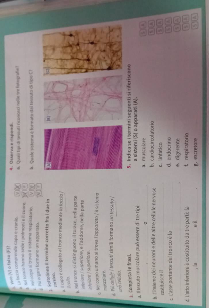 Vero (V) o falso (F)?
4. Osserva e rispondi.
a. La faccia comprende capo e cranio. a a. Quali tipi di tessuti riconosci nelle tre fotografie?
b. Nel torace hanno sede i polmoni e il cuore. F
c. Nel corpo si trova il sistema respiratorio. V b. Quale sistema è formato dal tessuto di tipo C?
d. Più organi formano un apparato. a F
2. Sottolinea il termine corretto fra i due in
corsivo.
a. Il capo è collegato al tronco mediante la faccia |
i collo.
b. Nel tronco si distinguono il torace, nella parte
inferiore / superiore, e l'addome, nella parte
inferiore / superiore.
c. Nel corpo umano si trova l’apparato / il sistema
muscolare.
d. Più cellule / tessuti simili formano un tessuto /
una cellula.
3. Completa le frasi. 5. Indica se i termini seguenti si riferiscono
a. Il tessuto muscolare può essere di tre tipi: a sistemi (S) o apparati (A).
_. a. muscolare a
b. L'insieme dei neuroni e delle altre cellule nervose b. cardiocircolatorio
o a
costituisce il_ c. linfatico A
`
c. L'asse portante del tronco è la _d. endocrino
60
_. e. digerente
GD
d. L'arto inferiore è costituito da tre parti: la f. respiratorio SIC
_, la_ e il_ g. escretore 5 a
、