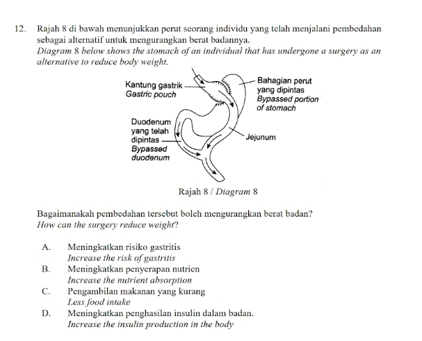 Rajah 8 di bawah menunjukkan perut seorang individu yang telah menjalani pembedahan
sebagai alternatif untuk mengurangkan berat badannya.
Diagram 8 below shows the stomach of an individual that has undergone a surgery as an
alternative to reduce body weight.
Bagaimanakah pembedahan tersebut boleh mengurangkan berat badan?
How can the surgery reduce weight?
A. Meningkatkan risiko gastritis
Increase the risk of gastritis
B. Meningkatkan penyerapan nutrien
Increase the nutrient absorption
C. Pengambilan makanan yang kurang
Less food intake
D. Meningkatkan penghasilan insulin dalam badan.
Increase the insulin production in the body