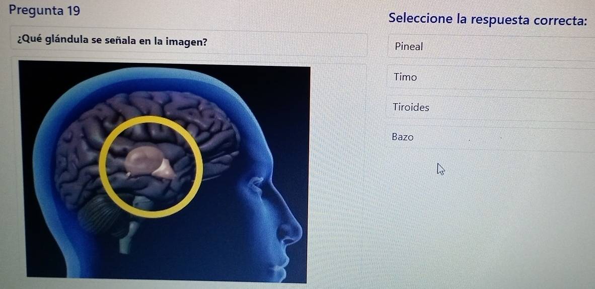 Pregunta 19 Seleccione la respuesta correcta:
¿Qué glándula se señala en la imagen? Pineal
Timo
Tiroides
Bazo