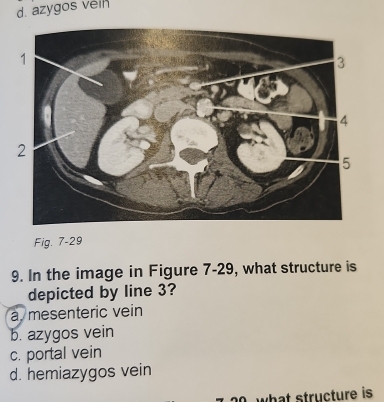 azygos vein
Fig. 7-29
9. In the image in Figure 7-29, what structure is
depicted by line 3?
a mesenteric vein
b. azygos vein
c. portal vein
d. hemiazygos vein
what structure is