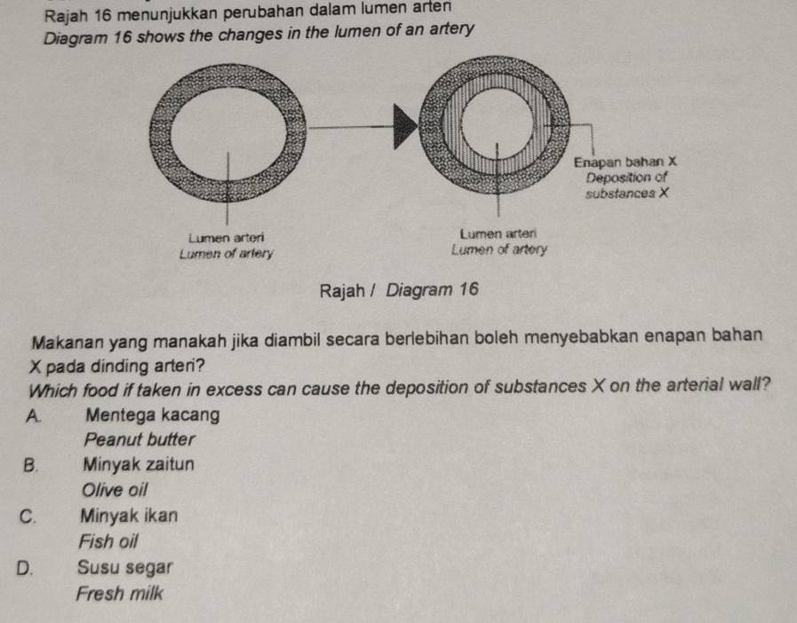 Rajah 16 menunjukkan perubahan dalam lumen arten
Diagram 16 shows the changes in the lumen of an artery
Rajah / Diagram 16
Makanan yang manakah jika diambil secara berlebihan boleh menyebabkan enapan bahan
X pada dinding arteri?
Which food if taken in excess can cause the deposition of substances X on the arterial wall?
A. Mentega kacang
Peanut butter
B. Minyak zaitun
Olive oil
C. Minyak ikan
Fish oil
D. Susu segar
Fresh milk