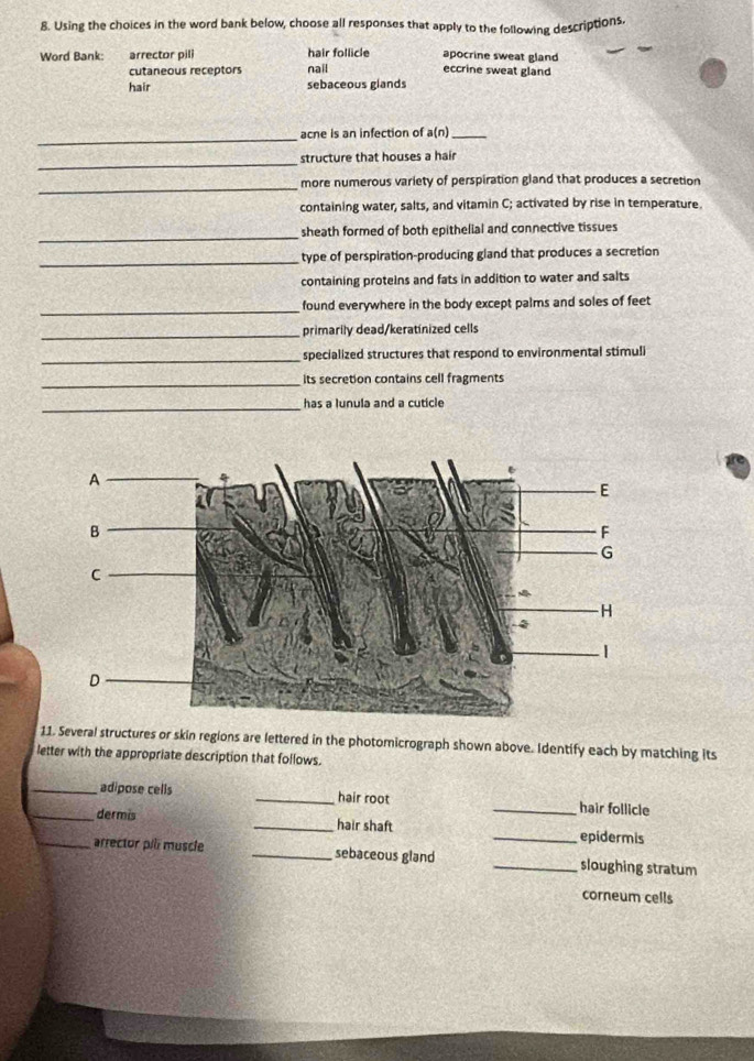Using the choices in the word bank below, choose all responses that apply to the following descriptions.
Word Bank: arrector pili hair follicle apocrine sweat gland eccrine sweat gland
cutaneous receptors nail
hair sebaceous glands
_
acne is an infection of a(n)_
_
structure that houses a hair
_
more numerous variety of perspiration gland that produces a secretion
containing water, salts, and vitamin C; activated by rise in temperature.
_sheath formed of both epithelial and connective tissues
_type of perspiration-producing gland that produces a secretion
containing proteins and fats in addition to water and saits
_found everywhere in the body except palms and soles of feet
_primarily dead/keratinized cells
_
specialized structures that respond to environmental stimuli
_its secretion contains cell fragments
_has a lunula and a cuticle
11. Several structures or skin regions are lettered in the photomicrograph shown above. Identify each by matching its
letter with the appropriate description that follows.
_adipose cells _hair root _hair follicle
_dermis _hair shaft _epidermis
_arrector pili muscle _sebaceous gland _sloughing stratum
corneum cells