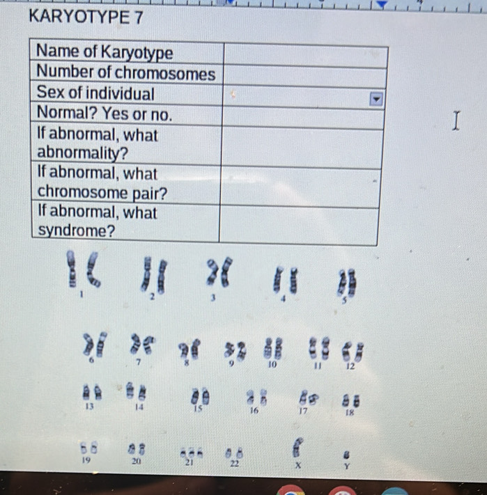 KARYOTYPE 7
2 3 4 5
a 
| 12
13 14
19 20 21 22 x γ