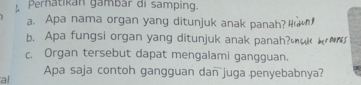 Perhatikan gambar di samping. 
a. Apa nama organ yang ditunjuk anak panah? 
b. Apa fungsi organ yang ditunjuk anak panah? 
c. Organ tersebut dapat mengalami gangguan. 
Apa saja contoh gangguan dan juga penyebabnya? 
al