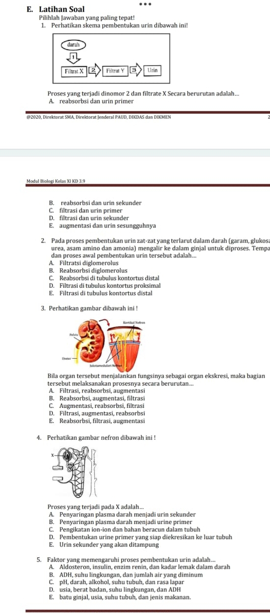 Latihan Soal
Pilihlah Jawaban yang paling tepat!
1. Perhatikan skema pembentukan urin dibawah ini!
darah
Filtrat X Filtrat Y 3 Urin
Proses yang terjadi dinomor 2 dan filtrate X Secara berurutan adalah...
A. reabsorbsi dan urin primer
@2020, Direktorat SMA, Direktorat Jenderal PAUD, DIKDAS dan DIKMEN
Modul Biologi Kelas XI KD 3.9
B. reabsorbsi dan urin sekunder
C. filtrasi dan urin primer
D. filtrasi dan urin sekunder
E. augmentasi dan urin sesungguhnya
2. Pada proses pembentukan urin zat-zat yang terlarut dalam darah (garam, glukosa
urea, asam amino dan amonia) mengalir ke dalam ginjal untuk diproses. Tempa
dan proses awal pembentukan urin tersebut adalah...
A. Filtratsi diglomerolus
B. Reabsorbsi diglomerolus
C. Reabsorbsi di tubulus kontortus distal
D. Filtrasi di tubulus kontortus proksimal
E. Filtrasi di tubulus kontortus distal
3. Perhatikan gambar dibawah ini !
Bila organ tersebut menjalankan fungsinya sebagai organ ekskresi, maka bagian
tersebut melaksanakan prosesnya secara berurutan...
A. Filtrasi, reabsorbsi, augmentasi
B. Reabsorbsi, augmentasi, filtrasi
C. Augmentasi, reabsorbsi, filtrasi
D. Filtrasi, augmentasi, reabsorbsi
E. Reabsorbsi, filtrasi, augmentasi
4. Perhatikan gambar nefron dibawah ini !
Proses yang terjadi pada X adalah...
A. Penyaringan plasma darah menjadi urin sekunder
B. Penyaringan plasma darah menjadi urine primer
C. Pengikatan ion-ion dan bahan beracun dalam tubuh
D. Pembentukan urine primer yang siap diekresikan ke luar tubuh
E. Urin sekunder yang akan ditampung
5. Faktor yang memengaruhi proses pembentukan urin adalah...
A. Aldosteron, insulin, enzim renin, dan kadar lemak dalam darah
B. ADH, suhu lingkungan, dan jumlah air yang diminum
C. pH, darah, alkohol, suhu tubuh, dan rasa lapar
D. usia, berat badan, suhu lingkungan, dan ADH
E. batu ginjal, usia, suhu tubuh, dan jenis makanan.