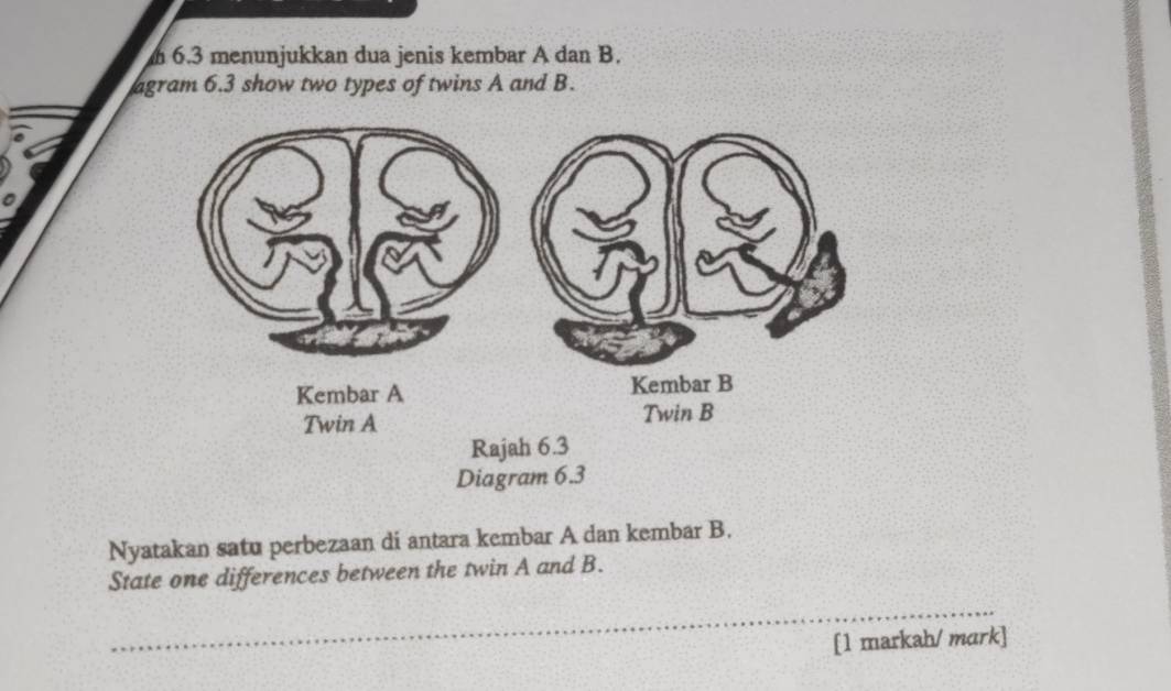 6.3 menunjukkan dua jenis kembar A dan B. 
agram 6.3 show two types of twins A and B. 
Nyatakan satu perbezaan di antara kembar A dan kembar B. 
State one differences between the twin A and B. 
_ 
[1 markah/ mark]