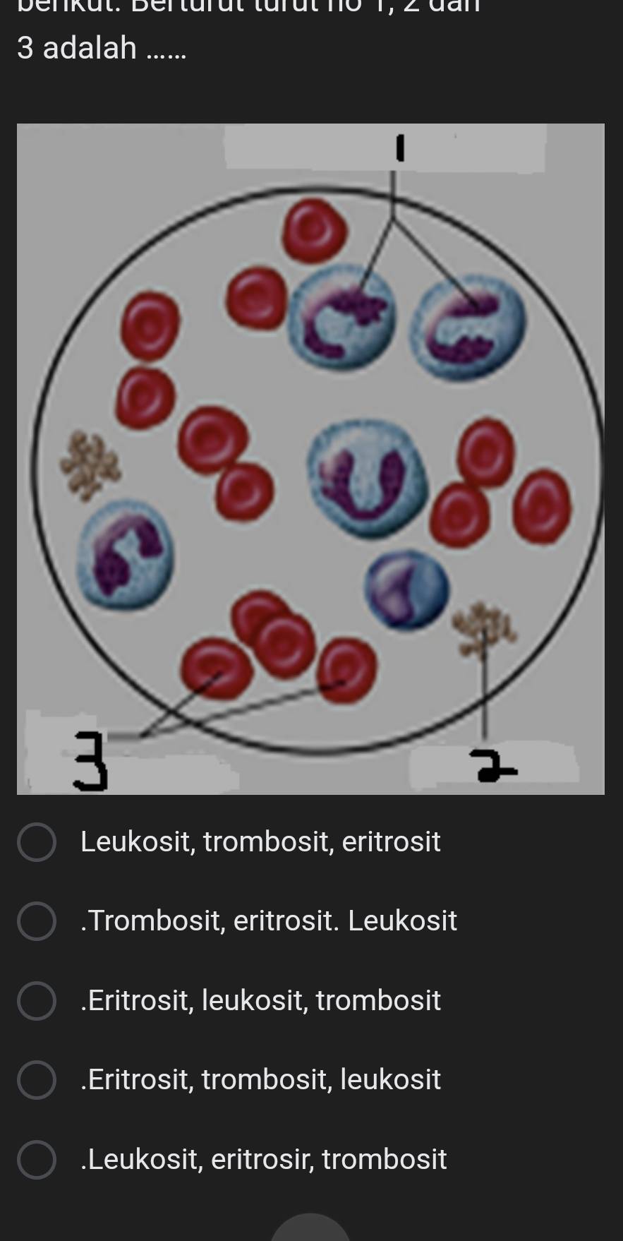 berkut. Derturut turüt no 1, 2 đần
3 adalah ......
Leukosit, trombosit, eritrosit.Trombosit, eritrosit. Leukosit.Eritrosit, leukosit, trombosit.Eritrosit, trombosit, leukosit.Leukosit, eritrosir, trombosit