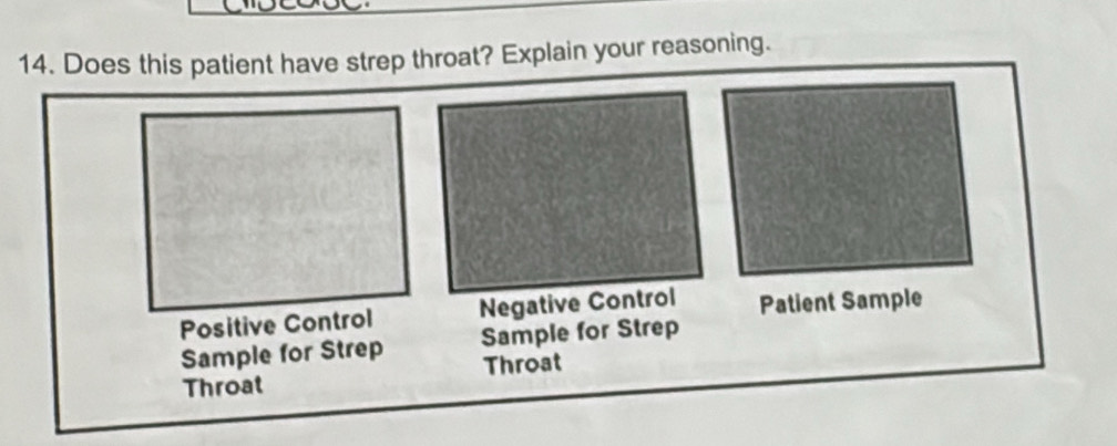 strep throat? Explain your reasoning.