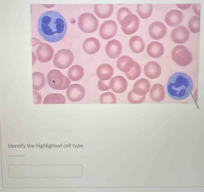 Identify the highlighted cell type. 
_