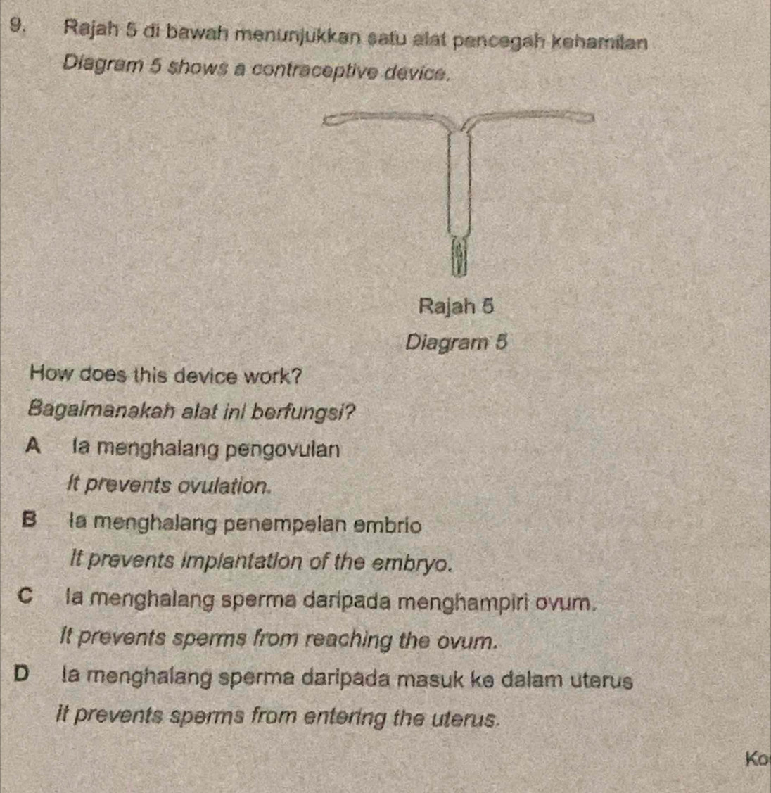 Rajah 5 di bawah menunjukkan satu alat pencegah kehamilan
Diagram 5 shows a contraceptive device.
Rajah 5
Diagram 5
How does this device work?
Bagaimanakah alat ini berfungsi?
A la menghalang pengovulan
It prevents ovulation.
B la menghalang penempelan embrio
It prevents implantation of the embryo.
C la menghalang sperma daripada menghampiri ovum.
It prevents sperms from reaching the ovum.
D a menghalang sperma daripada masuk ke dalam uterus
it prevents sperms from entering the uterus.
Ko