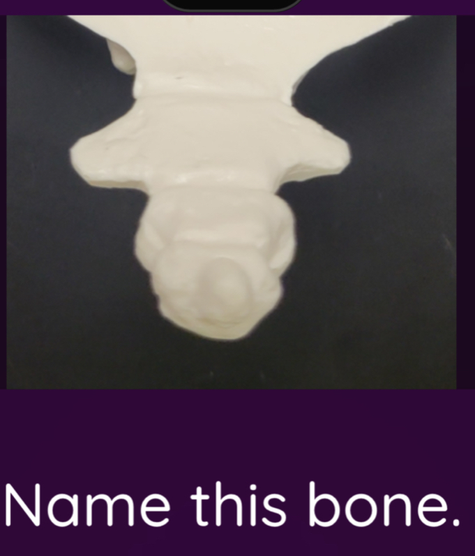 Name this bone.