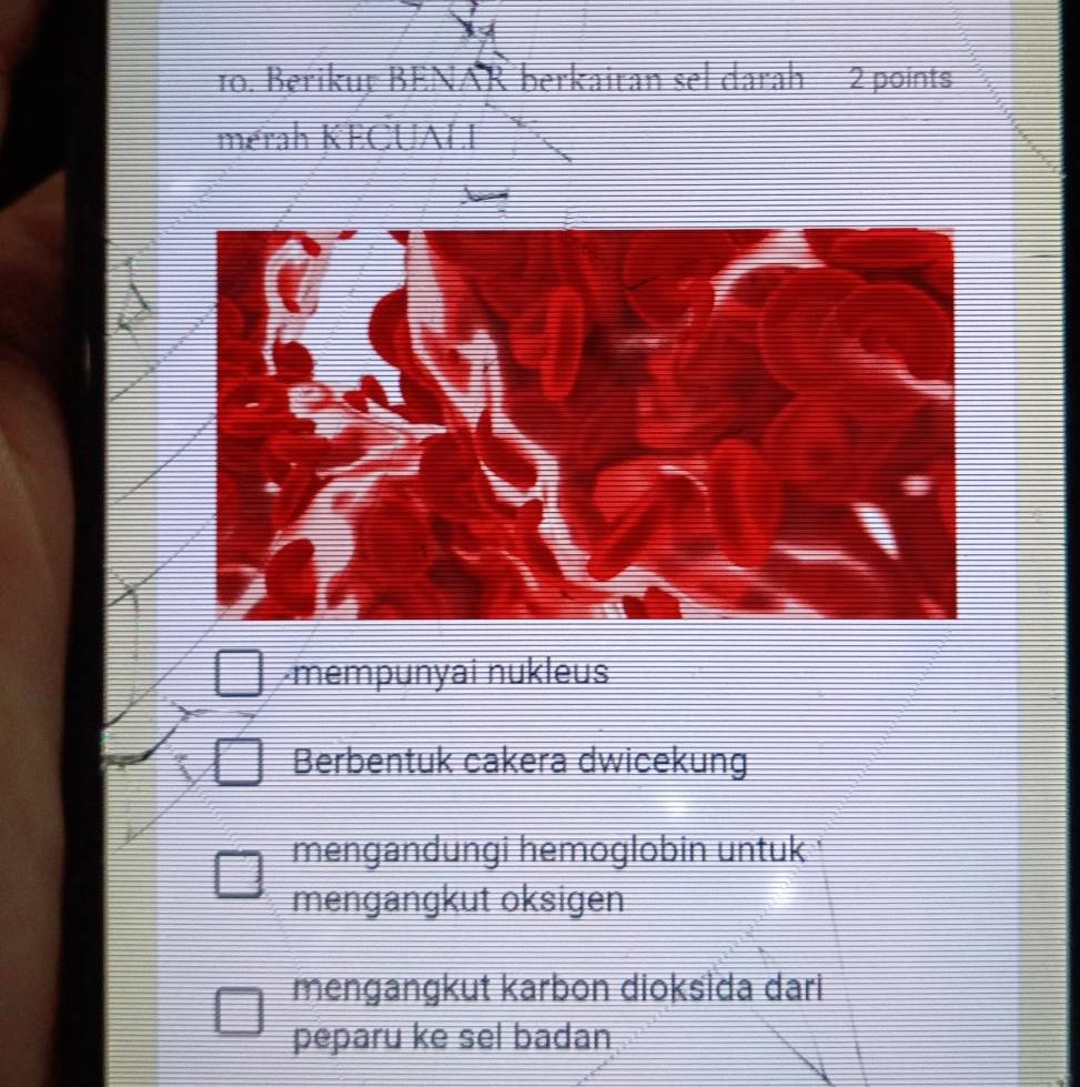 Berikur BENAR berkairan sel darah 2 points
merah KECUALI
-mempunyai nukleus
Berbentuk cakera dwicekung
mengandungi hemoglobin untuk
mengangkut oksigen
mengangkut karbon dioksida dari
peparu ke sel badan