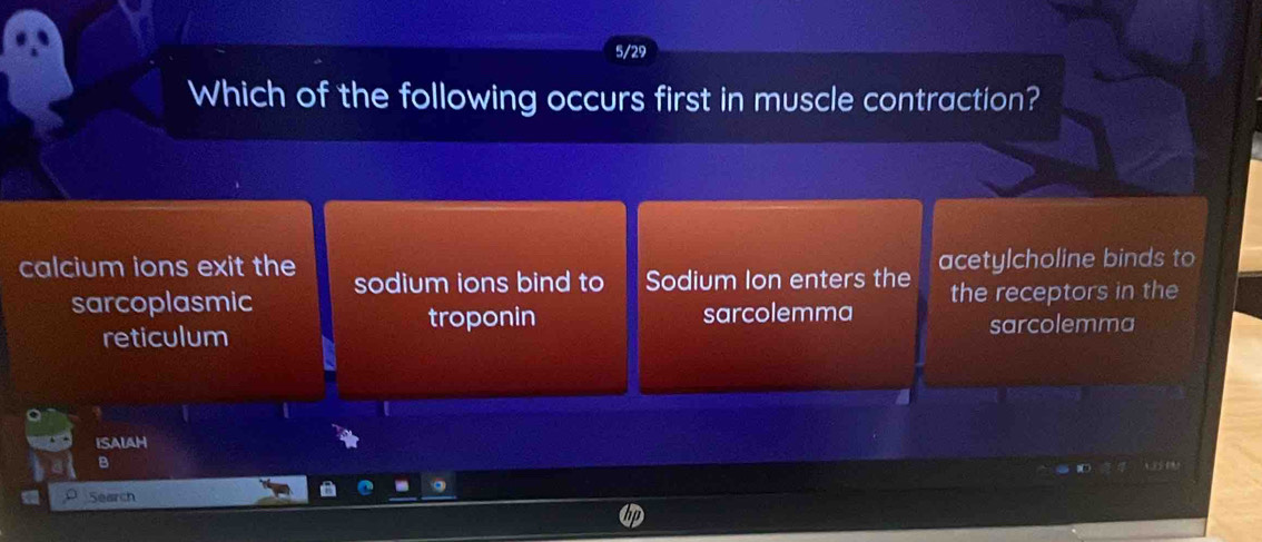 5/29
Which of the following occurs first in muscle contraction?
calcium ions exit the sodium ions bind to Sodium Ion enters the acetylcholine binds to
sarcoplasmic the receptors in the
troponin sarcolemma
reticulum sarcolemma
ISALAH
Search