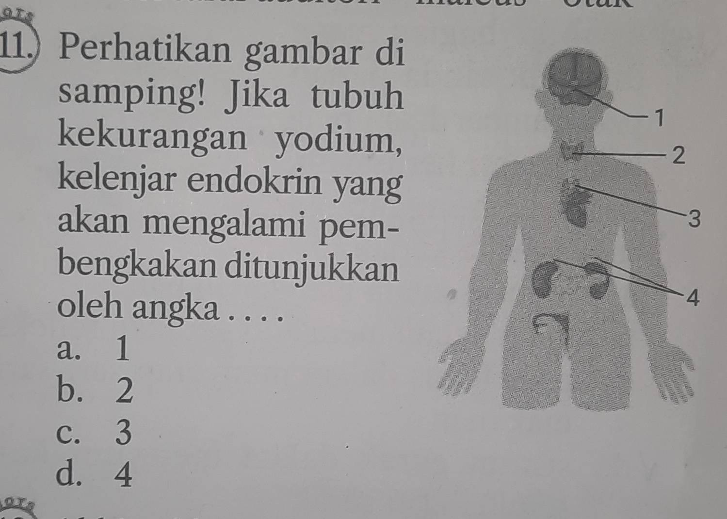 OTS
11) Perhatikan gambar di
samping! Jika tubuh
kekurangan yodium,
kelenjar endokrin yang
akan mengalami pem-
bengkakan ditunjukkan
oleh angka . . . .
a. 1
b. 2
c. 3
d. 4