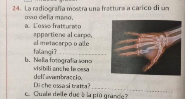 La radiografia mostra una frattura a carico di un 
osso della mano. 
a. L’osso fratturato 
appartiene al carpo, 
al metacarpo o alle 
falangi?_ 
b. Nella fotografia sono 
visibili anche le ossa 
dell'avambraccio. 
_ 
Di che ossa si tratta? 
c. Quale delle due è la più grande?