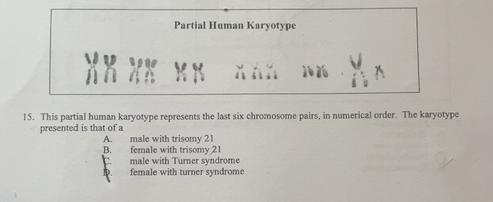 Solved: Partial Human Karyotype 15. This partial human karyotype ...