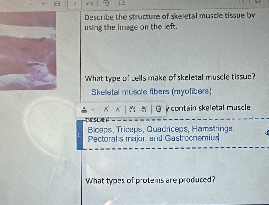 of 2 
Describe the structure of skeletal muscle tissue by 
using the image on the left. 
What type of cells make of skeletal muscle tissue? 
Skeletal muscle fibers (myofibers) 
A A e N y contain skeletal muscle 
tissue r 
Biceps, Triceps, Quadriceps, Hamstrings, 
Pectoralis major, and Gastrocnemius 
What types of proteins are produced?