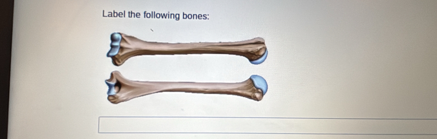 Label the following bones: