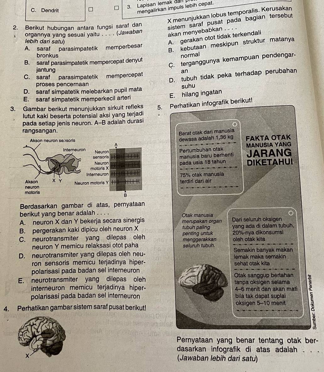 Lapisan lemak dan pi
C. Dendrit
mengalirkan impuls lebih cepat.
X menunjukkan lobus temporalis. Kerusakan
2. Berikut hubungan antara fungsi saraf dan
sistem saraf pusat pada bagian tersebut
organnya yang sesuai yaitu . . . . (Jawaban
akan menyebabkan . . . .
lebih dari satu)
A. gerakan otot tidak terkendali
B. kebutaan meskipun struktur matanya
A. saraf parasimpatetik memperbesar
bronkus normal
C. terganggunya kemampuan pendengar-
B. saraf parasimpatetik mempercepat denyut
jantung an
D. tubuh tidak peka terhadap perubahan
C. saraf parasimpatetik mempercepat
proses pencernaan
D. saraf simpatetik melebarkan pupil mata suhu
E. saraf simpatetik memperkecil arteri
E. hilang ingatan
3. Gambar berikut menunjukkan sirkuit refleks 5. Perhatikan infografik berikut!
lutut kaki beserta potensial aksi yang terjadi
pada setiap jenis neuron. A--B adalah durasi
rangsangan.
Berat otak dari manusia
dewasa adalah 1,36 kg
FAKTA OTAK
A MANUSIA YANG
Neuron
Pertumbuhan otak
sensoris JARANG
manusia baru berhenti
Neuron
motoris X pada usia 18 tahun DIKETAHUI
terneuron 75% otak manusia
motoris Y
terdiri darì air
B
Berdasarkan gambar di atas, pernyataan
berikut yang benar adalah . . . . Otak manusia
A. neuron X dan Y bekerja secara sinergis merupakan organ Dari seluruh oksigen
B. pergerakan kaki dipicu oleh neuron X tubuh paling yang ada di dalam tubuh,
C. neurotransmiter yang dilepas oleh penting untuk 20%-nya dikonsumsi
menggerakkan oleh otak kita
neuron Y memicu relaksasi otot paha seluruh tubuh.
Semakin banyak makan
D. neurotransmiter yang dilepas oleh neu-
lemak maka semakin
ron sensoris memicu terjadinya hiper- sehat otak kita
polarisasi pada badan sel interneuron
Otak sanggup bertahan
E. neurotransmiter yang dilepas oleh tanpa oksigen selama
interneuron memicu terjadinya hiper- 4-6 menit dan akan mati
polarisasi pada badan sel interneuron bila tak dapat suplai
4. Perhatikan gambar sistem saraf pusat berikut! oksigen 5-10 menit 5
Pernyataan yang benar tentang otak ber-
dasarkan infografik di atas adalah . . .
(Jawaban lebih dari satu)