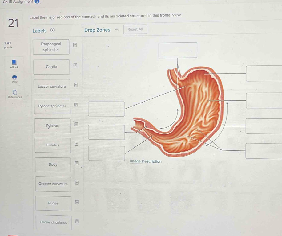 Solved: Ch 15 Assignment 21 Label the major regions of the stomach and ...