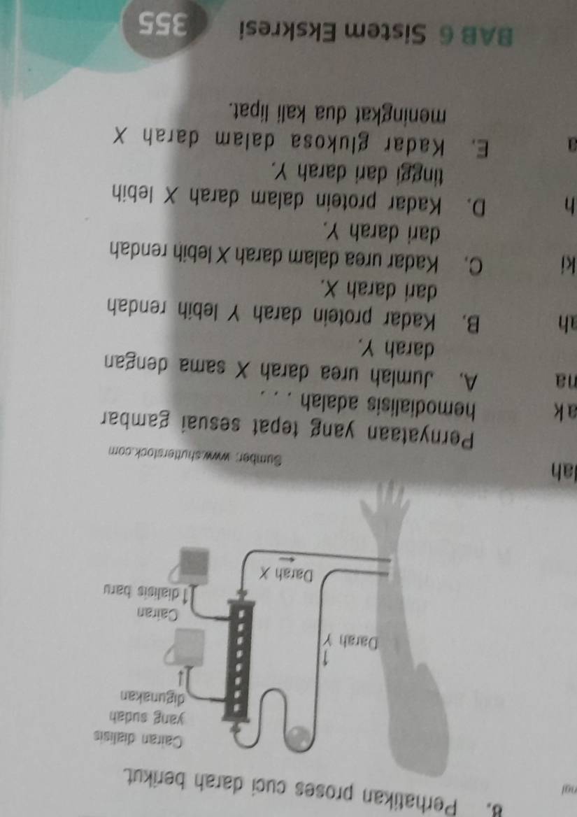 Perhatikan proses cuci d
oạt
lah
Sumber: www.shutterstock.com
Pernyataan yang tepat sesuai gambar
a k
hemodialisis adalah . . .
na
A. Jumlah urea darah X sama dengan
darah Y.
ah
B. Kadar protein darah Y lebih rendah
dari darah X.
ki
C. Kadar urea dalam darah X lebih rendah
dari darah Y.
h
D. Kadar protein dalam darah X lebih
tinggi dari darah Y.
a E. Kadar glukosa dalam darah X
meningkat dua kali lipat.
BAB 6 Sistem Ekskresi 355