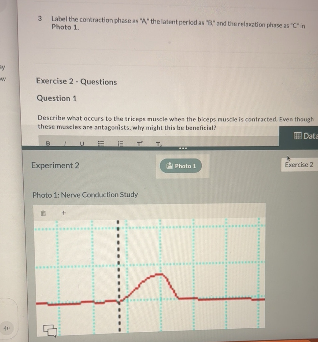 Solved: Label the contraction phase as '' A,' the latent period as ''B ...