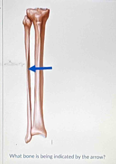 What bone is being indicated by the arrow?