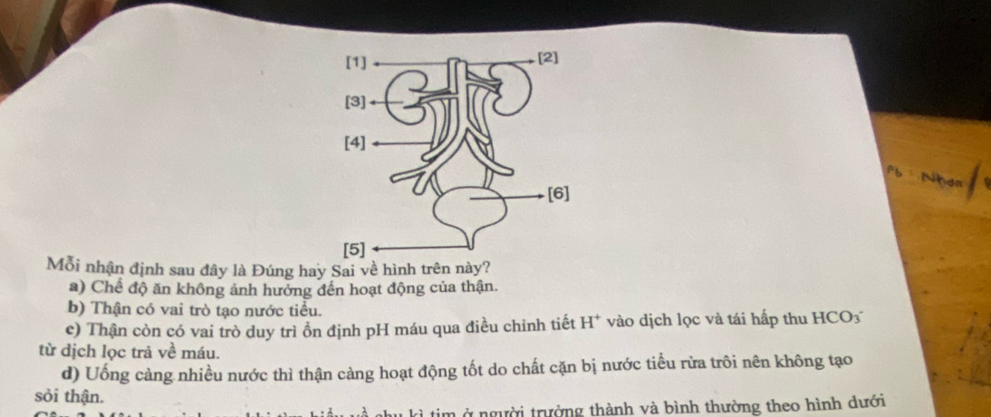 Mỗi nhận định sau đây là Đúng hay Sai về hình trên này?
a) Chế độ ăn không ảnh hưởng đến hoạt động của thận.
b) Thận có vai trò tạo nước tiểu.
c) Thận còn có vai trò duy trì ồn định pH máu qua điều chỉnh tiết H^+ vào dịch lọc và tái hấp thu HCO_3
từ dịch lọc trả về máu.
d) Uống càng nhiều nước thì thận càng hoạt động tốt do chất cặn bị nước tiểu rửa trôi nên không tạo
sỏi thận.
m ở người trường thành và bình thường theo hình dưới