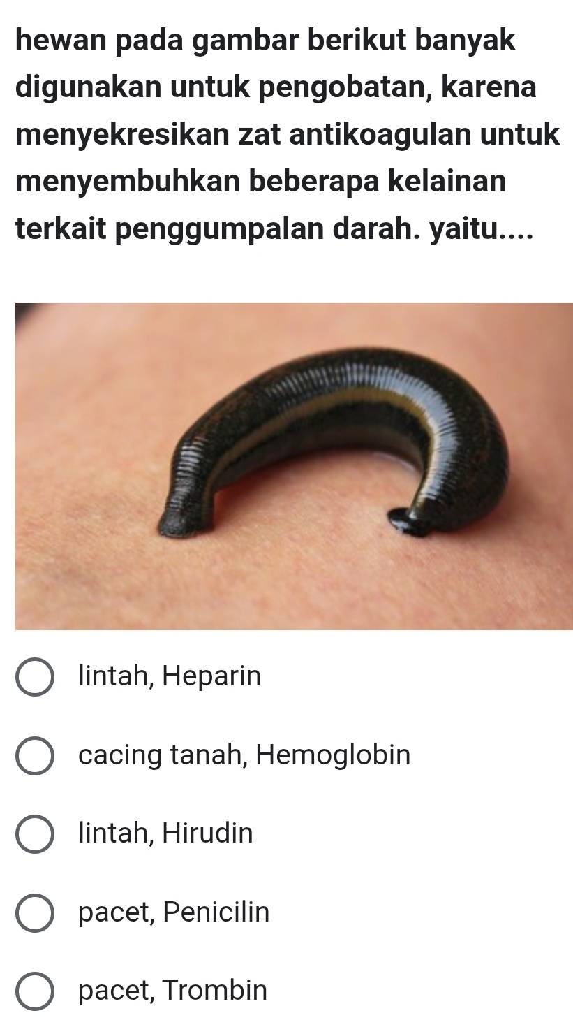 hewan pada gambar berikut banyak
digunakan untuk pengobatan, karena
menyekresikan zat antikoagulan untuk
menyembuhkan beberapa kelainan
terkait penggumpalan darah. yaitu....
lintah, Heparin
cacing tanah, Hemoglobin
lintah, Hirudin
pacet, Penicilin
pacet, Trombin